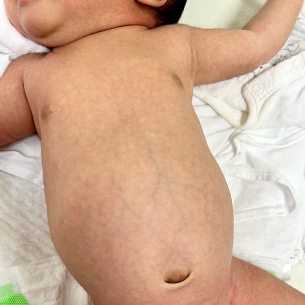 もちもち肌の赤ちゃん